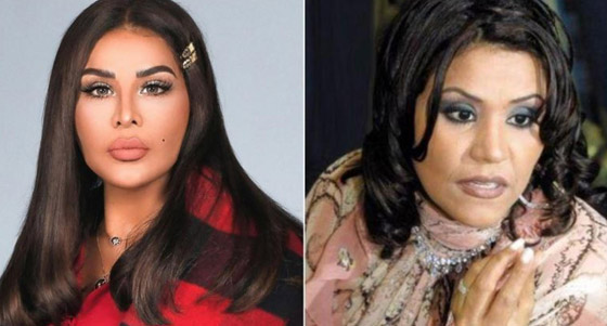 صور فنانات قبل وبعد عملية تجميل الأنف، بينهن نانسي عجرم، نجوى كرم ومي عز الدين صورة رقم 12