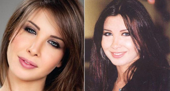 صور فنانات قبل وبعد عملية تجميل الأنف، بينهن نانسي عجرم، نجوى كرم ومي عز الدين صورة رقم 13