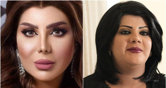 صور فنانات قبل وبعد عملية تجميل الأنف، بينهن نانسي عجرم، نجوى كرم ومي عز الدين صورة رقم 14