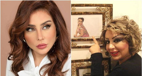 صور فنانات قبل وبعد عملية تجميل الأنف، بينهن نانسي عجرم، نجوى كرم ومي عز الدين صورة رقم 17
