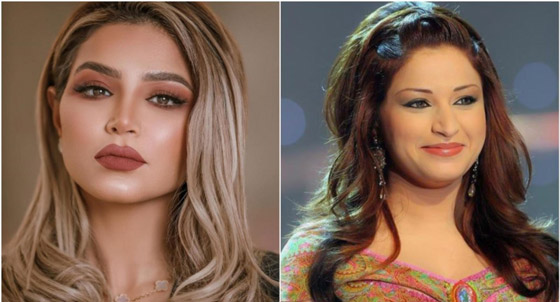 صور فنانات قبل وبعد عملية تجميل الأنف، بينهن نانسي عجرم، نجوى كرم ومي عز الدين صورة رقم 18