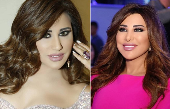 صور فنانات قبل وبعد عملية تجميل الأنف، بينهن نانسي عجرم، نجوى كرم ومي عز الدين صورة رقم 2