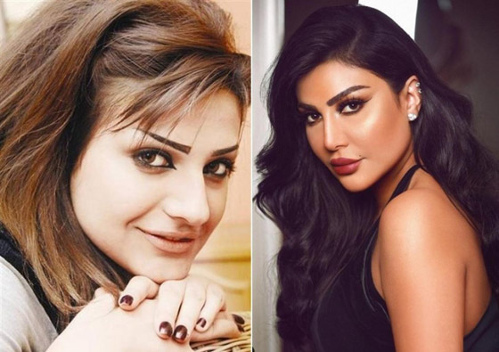 صور فنانات قبل وبعد عملية تجميل الأنف، بينهن نانسي عجرم، نجوى كرم ومي عز الدين صورة رقم 20