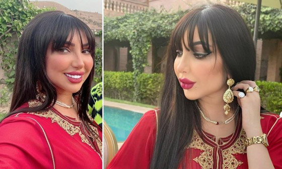 صور: والدة دنيا بطمة 