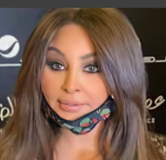 فيديو وصور اليسا بملامح مختلفة صادمة في حفلها بالرياض: شفاه ممتلئة ووجه مشدود! صورة رقم 3