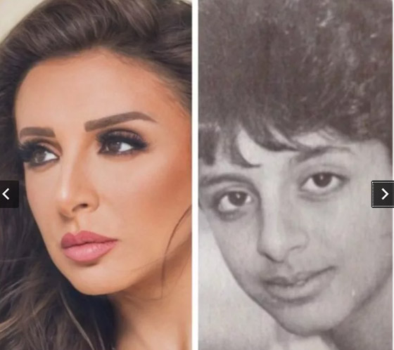 غيّرات جذريّة وصادمة: صور قديمة لـ أنغام قبل عمليات التجميل.. وهذا هو عمرها الحقيقي! صورة رقم 3