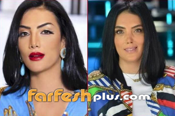 6 ‏نجمات غيرت عمليات التجميل ملامحهن وشوهتها.. صور قبل وبعد صورة رقم 5