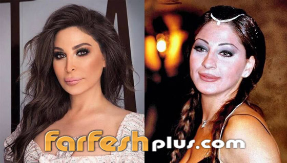 6 ‏نجمات غيرت عمليات التجميل ملامحهن وشوهتها.. صور قبل وبعد صورة رقم 4