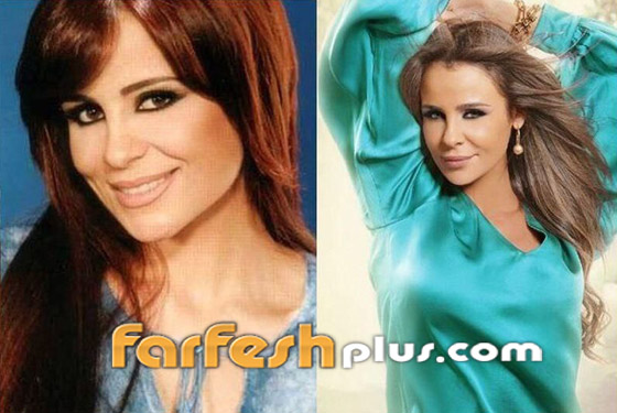 6 ‏نجمات غيرت عمليات التجميل ملامحهن وشوهتها.. صور قبل وبعد صورة رقم 6