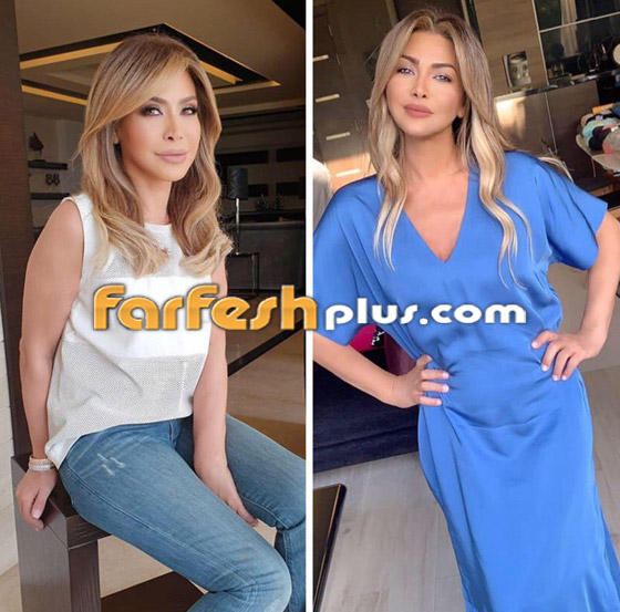 6 ‏نجمات غيرت عمليات التجميل ملامحهن وشوهتها.. صور قبل وبعد صورة رقم 2