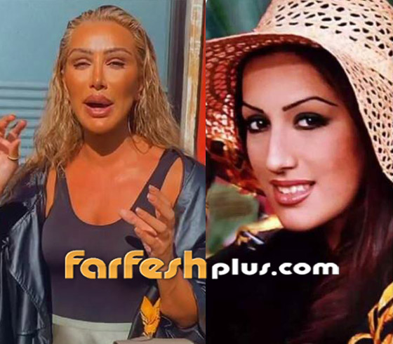 6 ‏نجمات غيرت عمليات التجميل ملامحهن وشوهتها.. صور قبل وبعد صورة رقم 1
