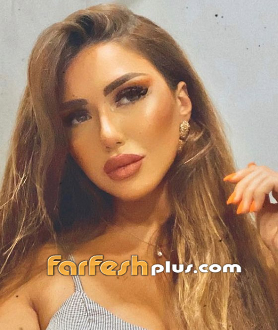 صور: عمليات التجميل تغير ملامح وجه سارة سلامة.. والجمهور: 