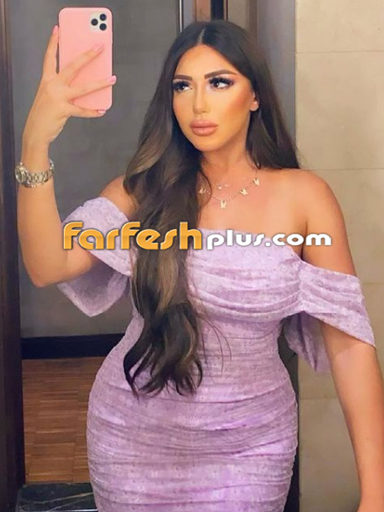 صور: عمليات التجميل تغير ملامح وجه سارة سلامة.. والجمهور: 
