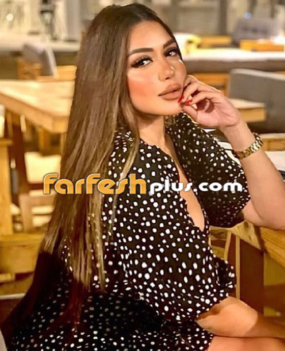 صور: عمليات التجميل تغير ملامح وجه سارة سلامة.. والجمهور: 