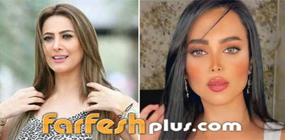 صور نجمات قبل وبعد عمليات التجميل والتغيير صادم: سوسن هارون، دنيا بطمة و صورة رقم 1