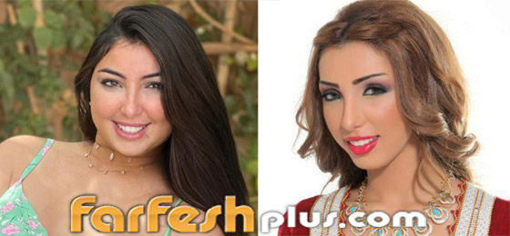 صور نجمات قبل وبعد عمليات التجميل والتغيير صادم: سوسن هارون، دنيا بطمة و صورة رقم 3