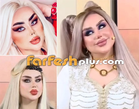 صور نجمات قبل وبعد عمليات التجميل والتغيير صادم: سوسن هارون، دنيا بطمة و صورة رقم 6
