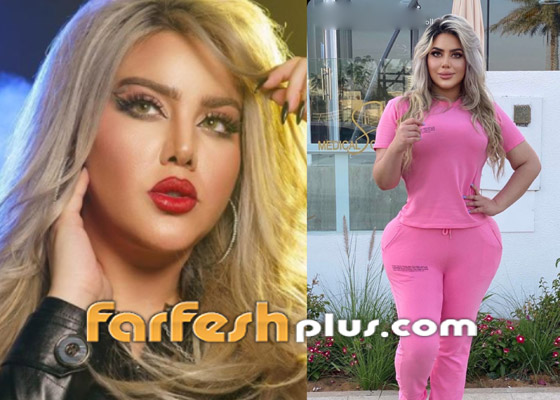 فيديوهات وصور صادمة: مروة راتب بأرداف ضخمة بعد عملية تجميل وتصف جسدها بالنار! صورة رقم 1