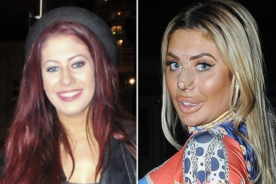 من ملكات جمال إلى مسوخ.. مشاهير أجروا عمليات تجميل كارثية صورة رقم 4
