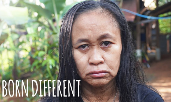 حالة نادرة.. فتاة فلبينية بعمر 16 عاما بوجه امرأة في سن الـ50! صورة رقم 4