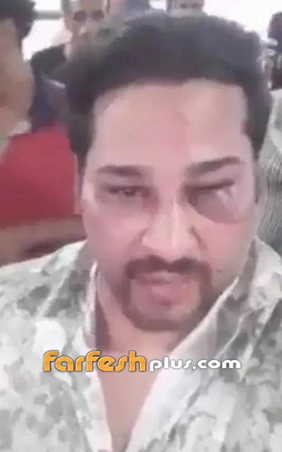 المغني الشعبي حمو بيكا إلى السجن.. إليكم صورة صادمة لضحيته! صورة رقم 1