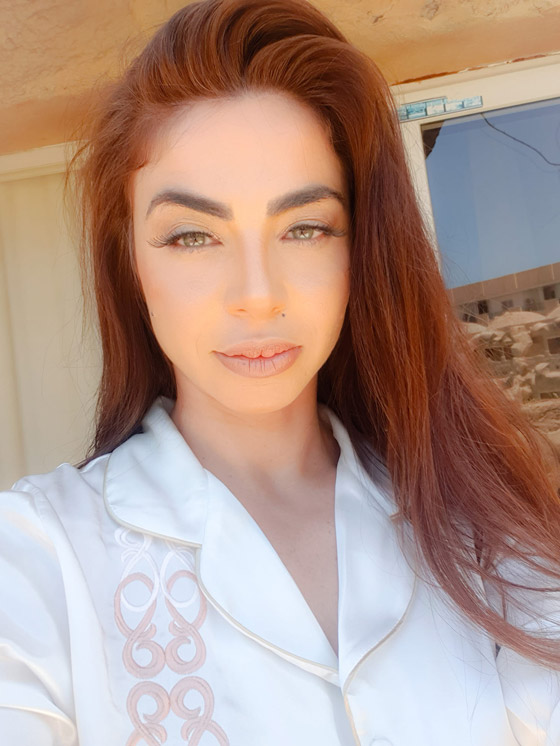 محام يطالب بسجن دوللي شاهين لادعائها كذبا تعرضها للضرب الوحشي صورة رقم 7