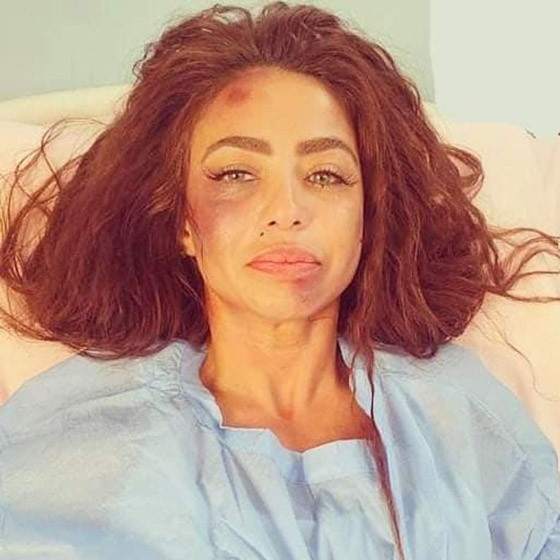 محام يطالب بسجن دوللي شاهين لادعائها كذبا تعرضها للضرب الوحشي صورة رقم 2