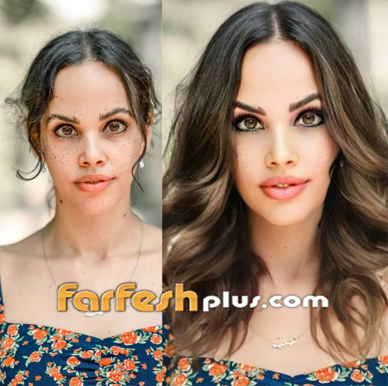 صورة ابنة عمرو دياب وتغيير كبير في وجهها! هل أجرت عملية تجميل؟ صورة رقم 1