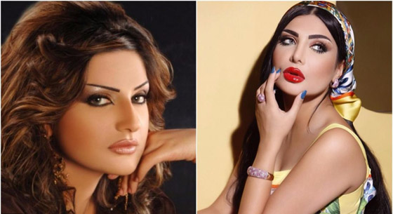 نجمات الخليج قبل وبعد التجميل  صور صادمه : صورة رقم 1