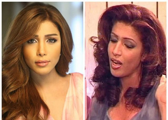نجمات الخليج قبل وبعد التجميل  صور صادمه : صورة رقم 5