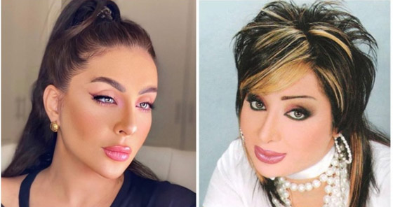 نجمات الخليج قبل وبعد التجميل  صور صادمه : صورة رقم 9