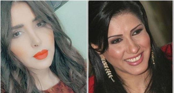 نجمات الخليج قبل وبعد التجميل  صور صادمه : صورة رقم 11