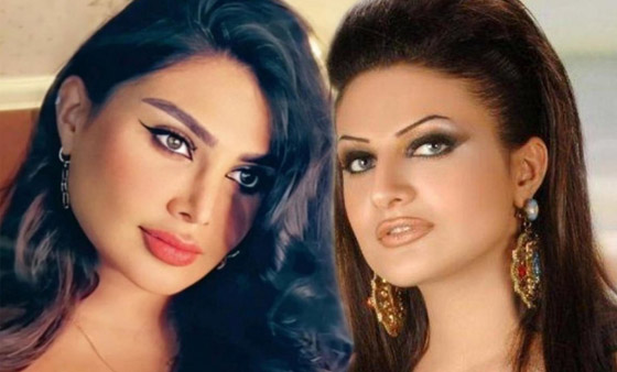 نجمات الخليج قبل وبعد التجميل  صور صادمه : صورة رقم 12
