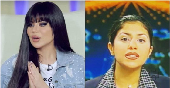 نجمات الخليج قبل وبعد التجميل  صور صادمه : صورة رقم 16