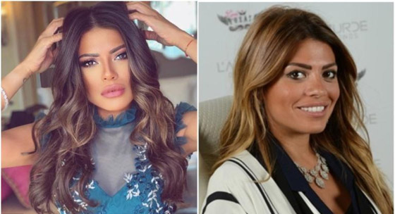 نجمات الخليج قبل وبعد التجميل  صور صادمه : صورة رقم 19