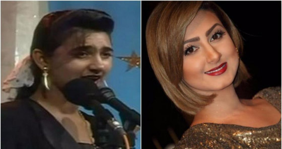 نجمات الخليج قبل وبعد التجميل  صور صادمه : صورة رقم 20