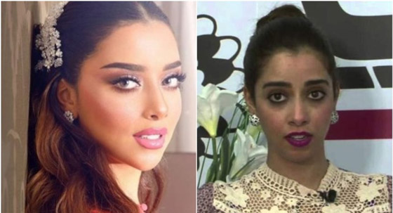 نجمات الخليج قبل وبعد التجميل  صور صادمه : صورة رقم 21