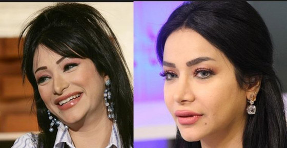 نجمات الخليج قبل وبعد التجميل  صور صادمه : صورة رقم 22