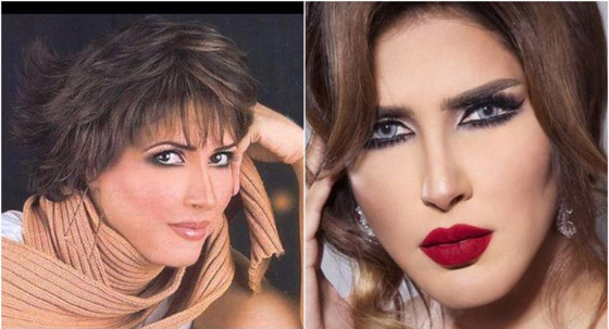 نجمات الخليج قبل وبعد التجميل  صور صادمه : صورة رقم 24