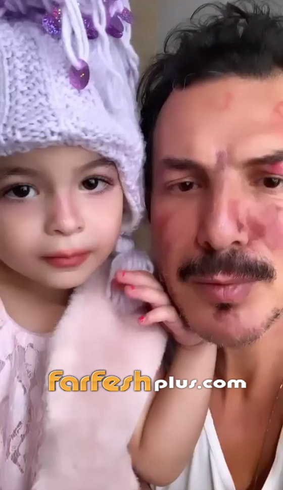 ابنة باسل خياط تخطف الأنظار بفيديو طريف: وهذا ما فعلته بوجه والدها صورة رقم 2