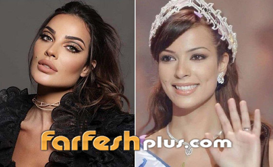 صور قبل وبعد: 15 فنانة اعترفن بإجراء عمليات تجميل غيرت شكلهن كليا صورة رقم 1