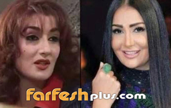 صور قبل وبعد: 15 فنانة اعترفن بإجراء عمليات تجميل غيرت شكلهن كليا صورة رقم 2