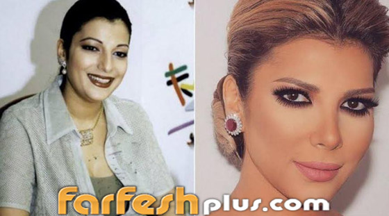 صور قبل وبعد: 15 فنانة اعترفن بإجراء عمليات تجميل غيرت شكلهن كليا صورة رقم 4
