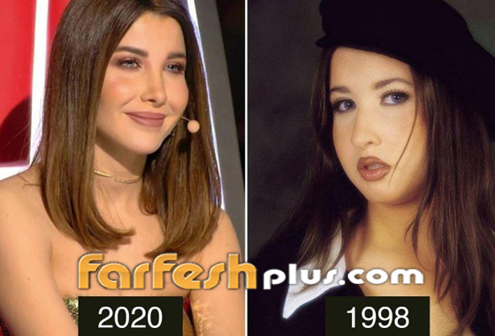 صور قبل وبعد: 15 فنانة اعترفن بإجراء عمليات تجميل غيرت شكلهن كليا صورة رقم 5