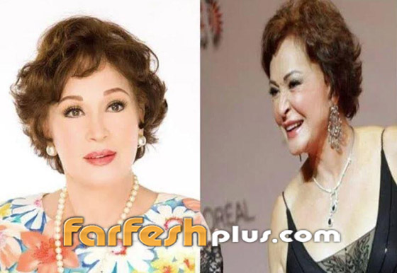 صور قبل وبعد: 15 فنانة اعترفن بإجراء عمليات تجميل غيرت شكلهن كليا صورة رقم 8