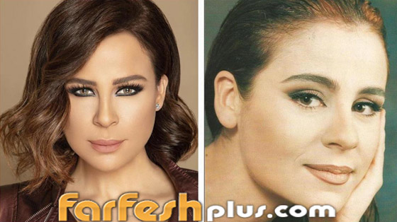 صور قبل وبعد: 15 فنانة اعترفن بإجراء عمليات تجميل غيرت شكلهن كليا صورة رقم 10
