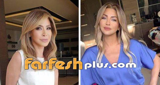 صور قبل وبعد: 15 فنانة اعترفن بإجراء عمليات تجميل غيرت شكلهن كليا صورة رقم 14