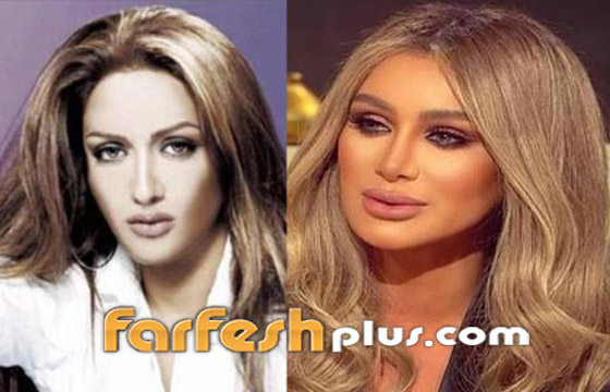 صور قبل وبعد: 15 فنانة اعترفن بإجراء عمليات تجميل غيرت شكلهن كليا صورة رقم 15