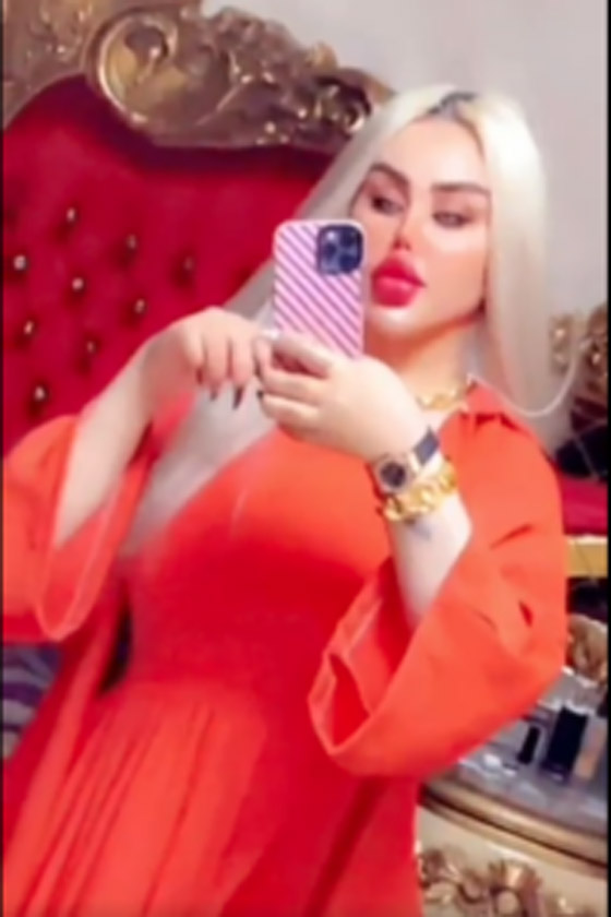 صور صادمة: داليا نعيم بعد عملية تجميلية، شفاهها مخيفة والجمهور: فيلم الرعب!! صورة رقم 1
