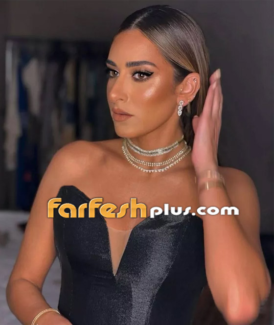 صور أمينة خليل قبل وبعد: هل أجرت عملية تجميل جديدة في أنفها؟ صورة رقم 4